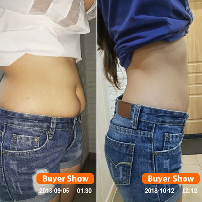 KONGDY 50Bags Weight Loss Patch Slimming Plaster Fast Burning Products Natural Herbs Navel Sticker Body Shaping Patches