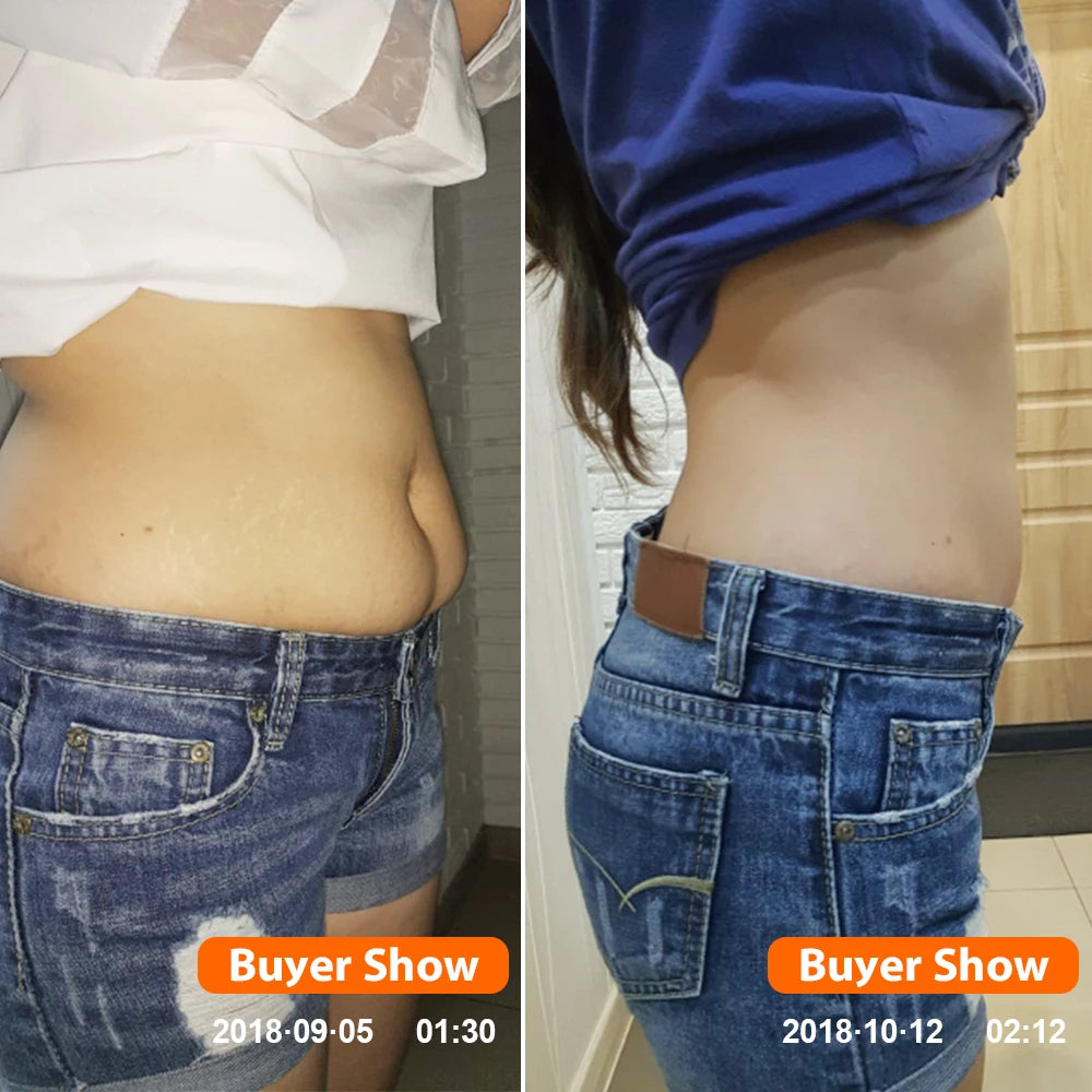 KONGDY 50Bags Weight Loss Patch Slimming Plaster Fast Burning Products Natural Herbs Navel Sticker Body Shaping Patches
