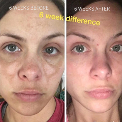 Brightening Face Serum Dark Spots Corrector Turmeric Toner Whitening Moisturizing Vitamin C Ginger Essence Korean Cosmetics