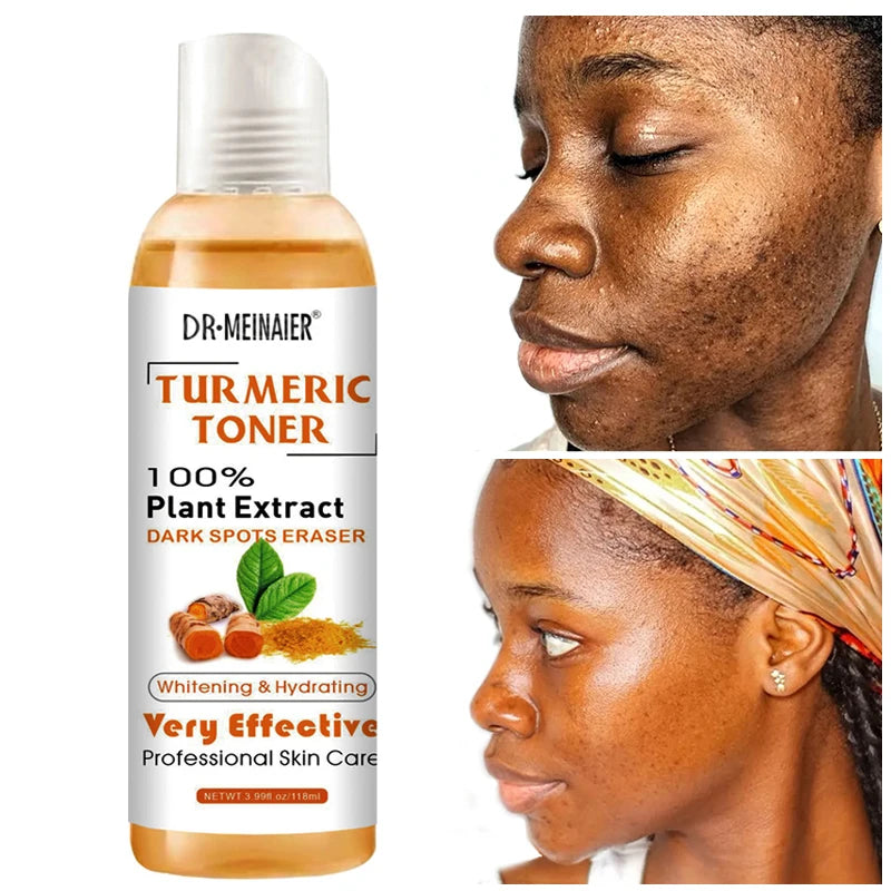 Brightening Face Serum Dark Spots Corrector Turmeric Toner Whitening Moisturizing Vitamin C Ginger Essence Korean Cosmetics